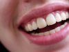 natural dental care smile